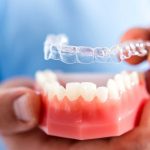 What is Cosmetic Dentistry